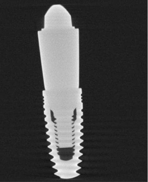 【産品應用】歐美進(jìn)口種(zhǒng)植牙釘用WERTHCT檢測種(zhǒng)植物